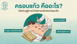 ครอบแก้ว แพทย์แผนจีน สายไหม