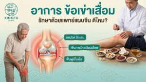 รักษาข้อเข่าเสื่อม แพทย์แผนจีน สายไหม